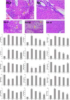 Study on the mechanism of acute liver injury protection in Rhubarb anthraquinone by metabolomics based on UPLC-Q-TOF-MS